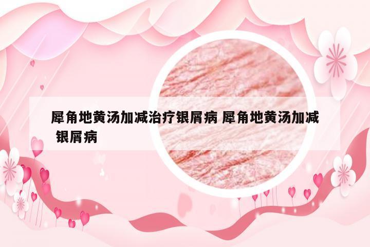 犀角地黄汤加减治疗银屑病 犀角地黄汤加减 银屑病
