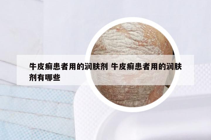 牛皮癣患者用的润肤剂 牛皮癣患者用的润肤剂有哪些