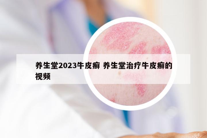 养生堂2023牛皮癣 养生堂治疗牛皮癣的视频