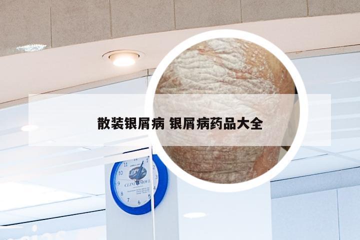 散装银屑病 银屑病药品大全