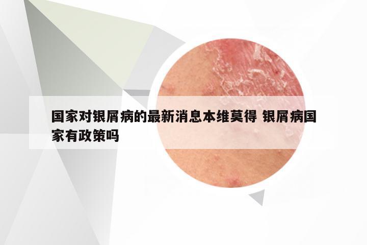 国家对银屑病的最新消息本维莫得 银屑病国家有政策吗