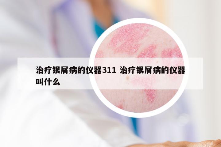 治疗银屑病的仪器311 治疗银屑病的仪器叫什么
