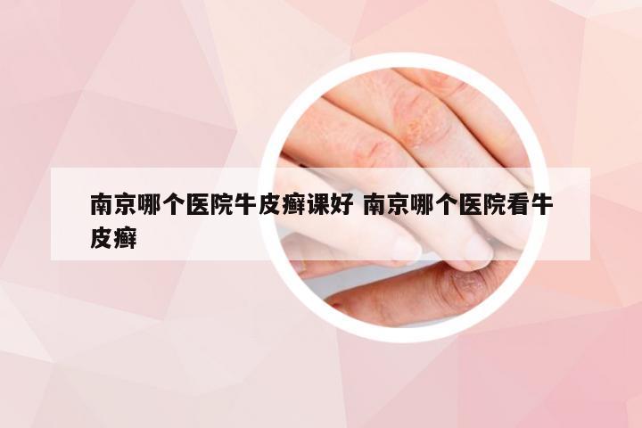 南京哪个医院牛皮癣课好 南京哪个医院看牛皮癣