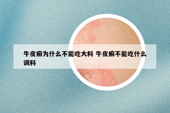 牛皮癣为什么不能吃大料 牛皮癣不能吃什么调料