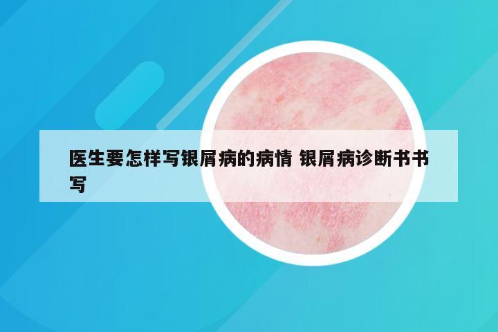 医生要怎样写银屑病的病情 银屑病诊断书书写