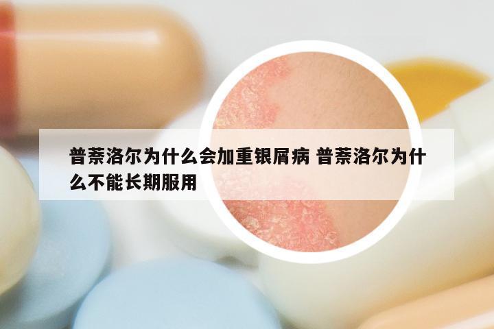 普萘洛尔为什么会加重银屑病 普萘洛尔为什么不能长期服用