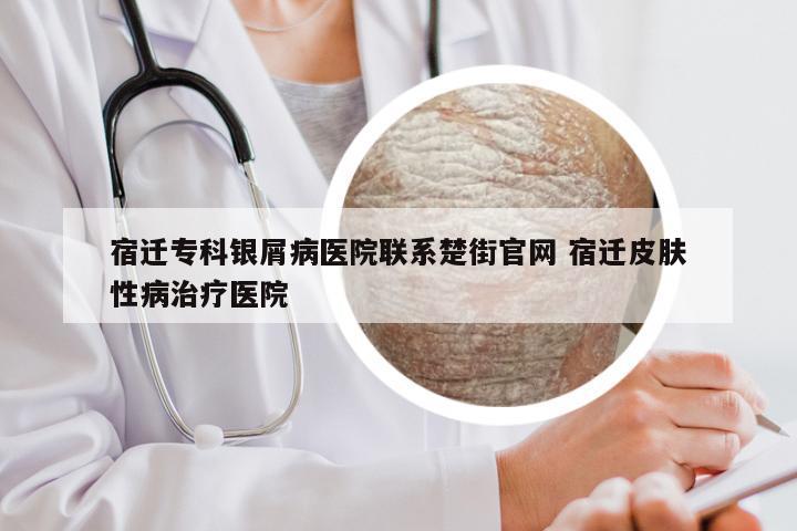 宿迁专科银屑病医院联系楚街官网 宿迁皮肤性病治疗医院
