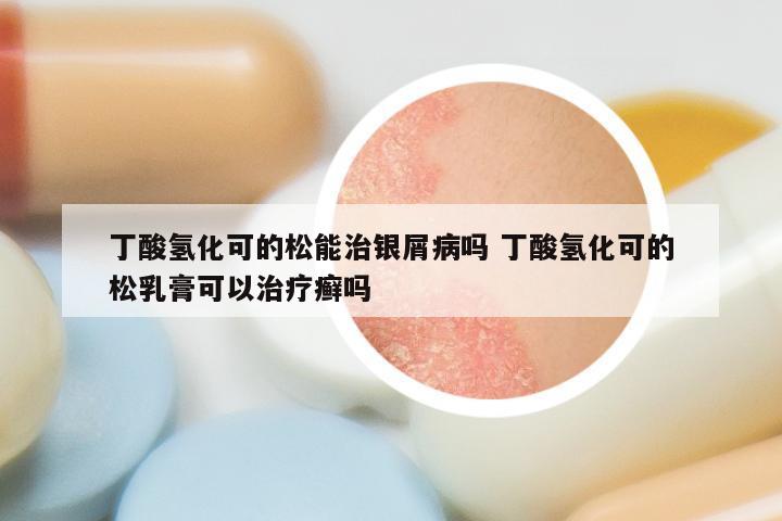 丁酸氢化可的松能治银屑病吗 丁酸氢化可的松乳膏可以治疗癣吗