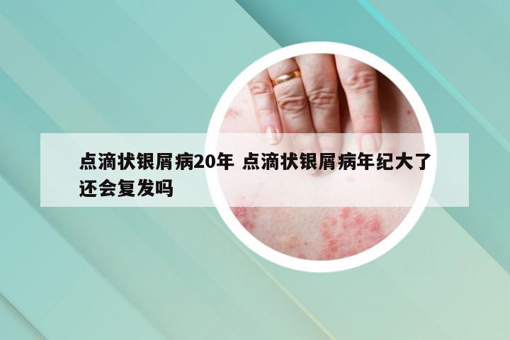 点滴状银屑病20年 点滴状银屑病年纪大了还会复发吗