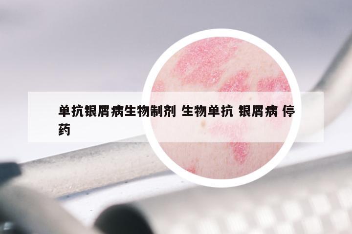 单抗银屑病生物制剂 生物单抗 银屑病 停药