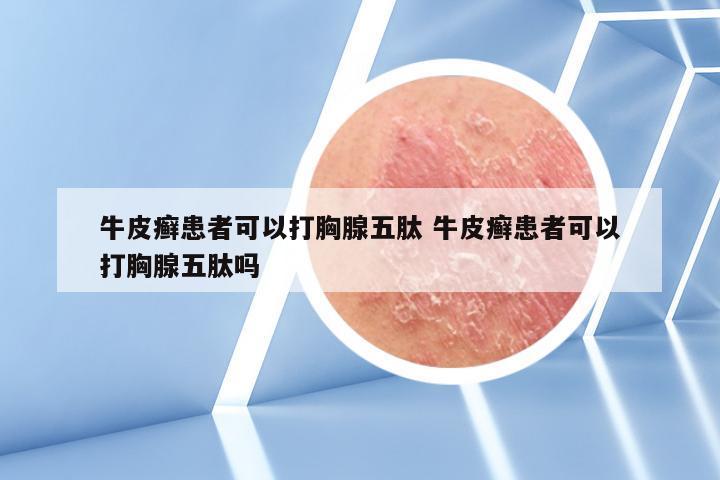 牛皮癣患者可以打胸腺五肽 牛皮癣患者可以打胸腺五肽吗