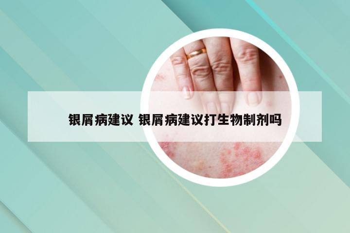 银屑病建议 银屑病建议打生物制剂吗