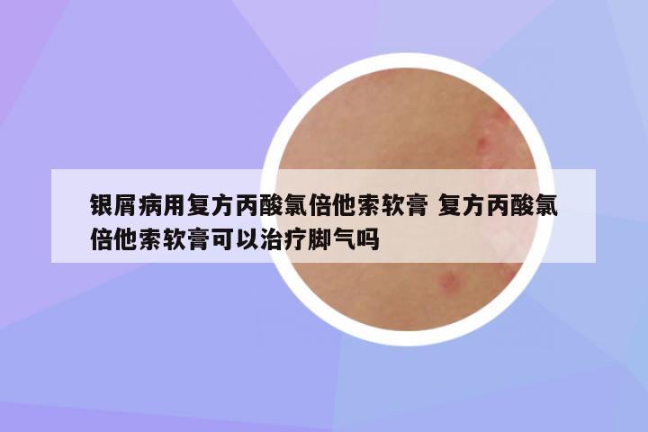 银屑病用复方丙酸氯倍他索软膏 复方丙酸氯倍他索软膏可以治疗脚气吗