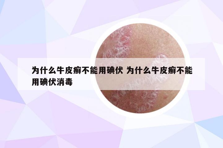 为什么牛皮癣不能用碘伏 为什么牛皮癣不能用碘伏消毒