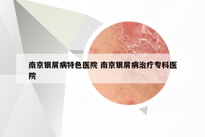 南京银屑病特色医院 南京银屑病治疗专科医院