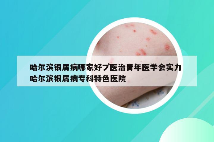 哈尔滨银屑病哪家好プ医治青年医学会实力 哈尔滨银屑病专科特色医院