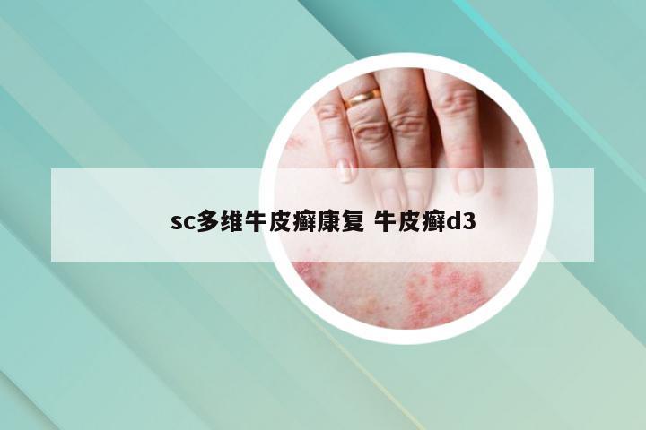 sc多维牛皮癣康复 牛皮癣d3
