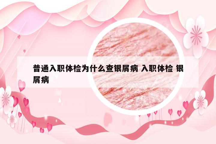 普通入职体检为什么查银屑病 入职体检 银屑病