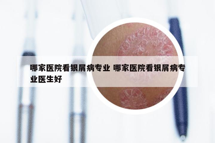哪家医院看银屑病专业 哪家医院看银屑病专业医生好