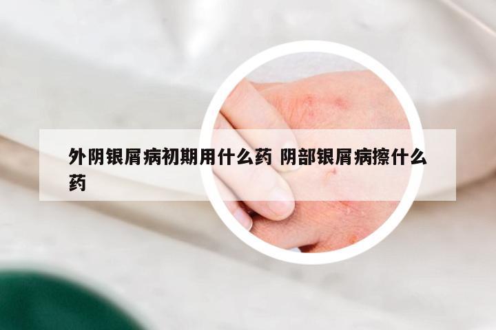 外阴银屑病初期用什么药 阴部银屑病擦什么药