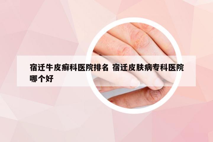宿迁牛皮癣科医院排名 宿迁皮肤病专科医院哪个好