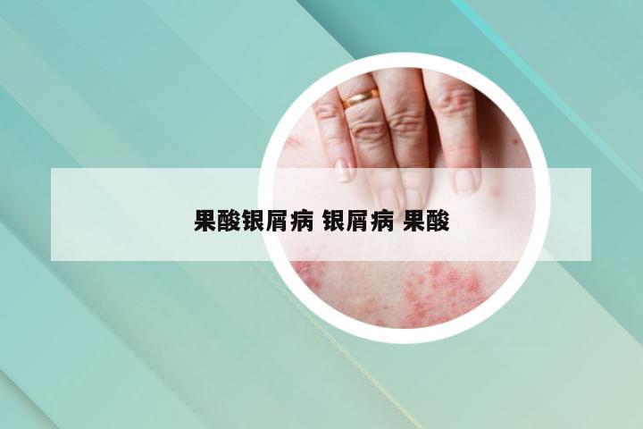 果酸银屑病 银屑病 果酸