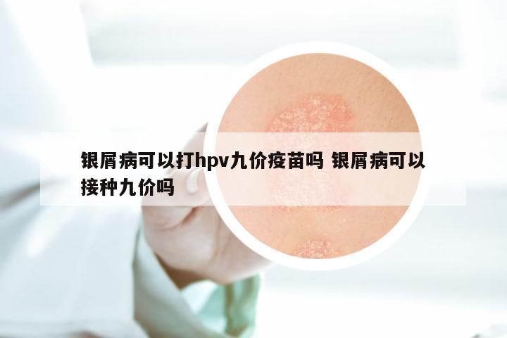 银屑病可以打hpv九价疫苗吗 银屑病可以接种九价吗