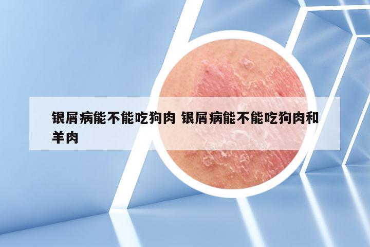银屑病能不能吃狗肉 银屑病能不能吃狗肉和羊肉