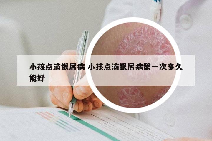 小孩点滴银屑病 小孩点滴银屑病第一次多久能好
