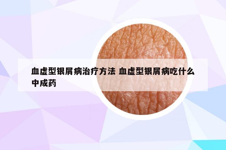 血虚型银屑病治疗方法 血虚型银屑病吃什么中成药