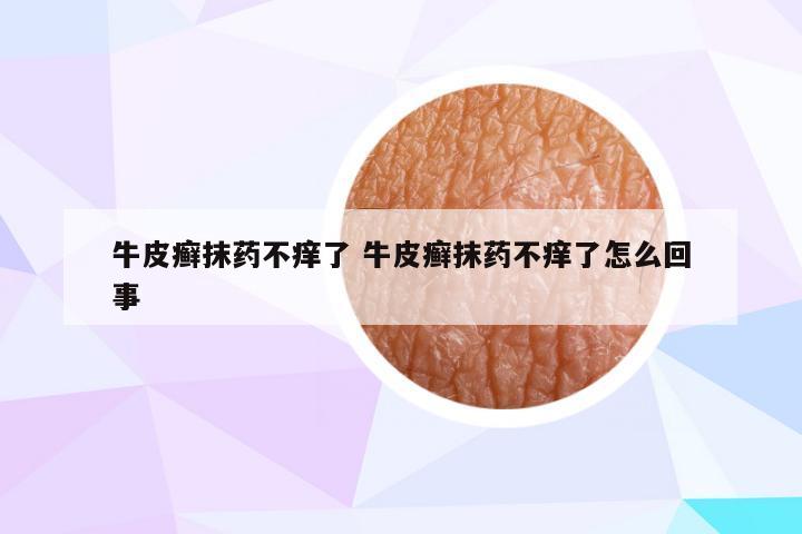 牛皮癣抹药不痒了 牛皮癣抹药不痒了怎么回事