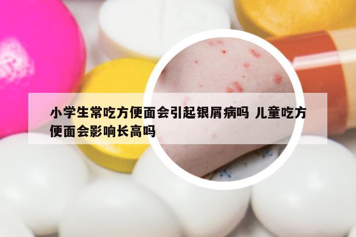 小学生常吃方便面会引起银屑病吗 儿童吃方便面会影响长高吗