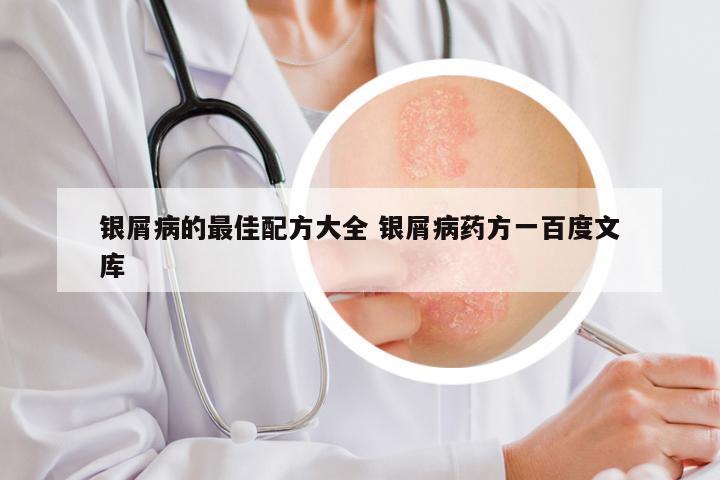 银屑病的最佳配方大全 银屑病药方一百度文库