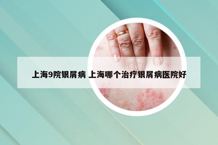 上海9院银屑病 上海哪个治疗银屑病医院好
