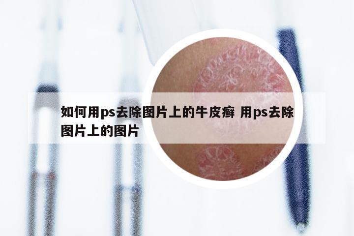 如何用ps去除图片上的牛皮癣 用ps去除图片上的图片