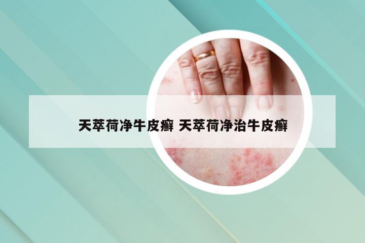 天萃荷净牛皮癣 天萃荷净治牛皮癣