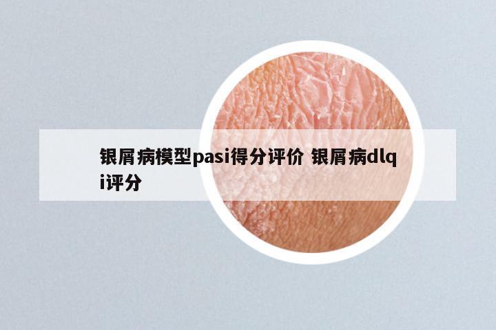 银屑病模型pasi得分评价 银屑病dlqi评分