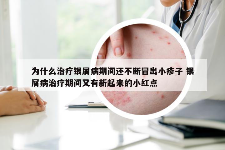 为什么治疗银屑病期间还不断冒出小疹子 银屑病治疗期间又有新起来的小红点