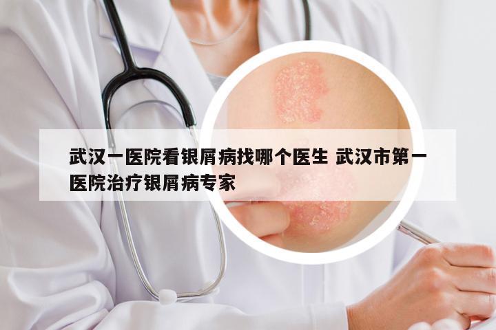 武汉一医院看银屑病找哪个医生 武汉市第一医院治疗银屑病专家