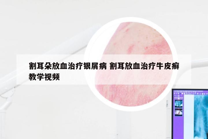 割耳朵放血治疗银屑病 割耳放血治疗牛皮癣教学视频