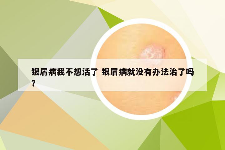 银屑病我不想活了 银屑病就没有办法治了吗?