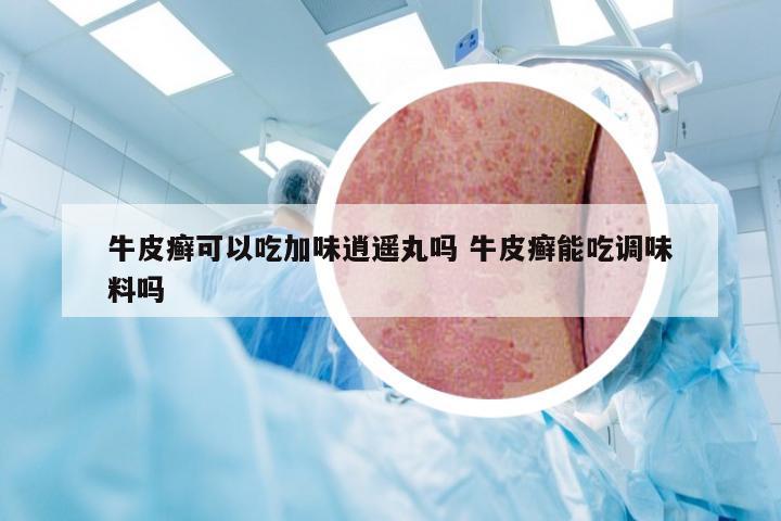牛皮癣可以吃加味逍遥丸吗 牛皮癣能吃调味料吗