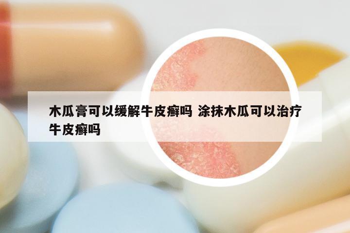 木瓜膏可以缓解牛皮癣吗 涂抹木瓜可以治疗牛皮癣吗