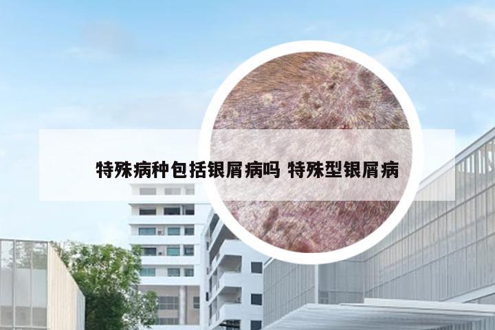 特殊病种包括银屑病吗 特殊型银屑病