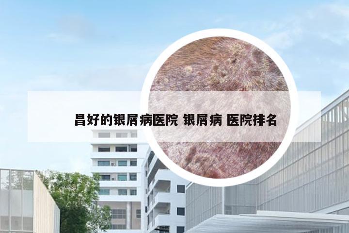 昌好的银屑病医院 银屑病 医院排名