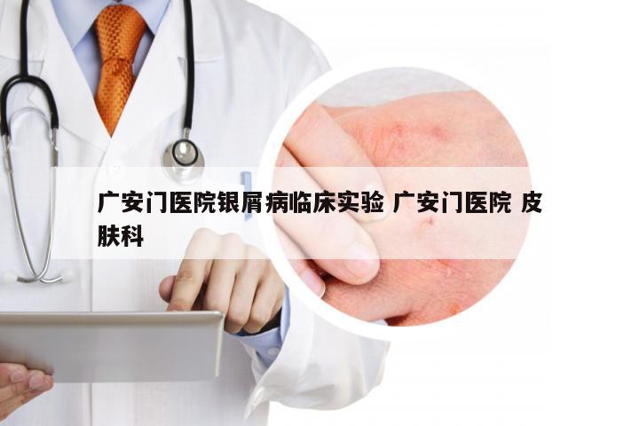广安门医院银屑病临床实验 广安门医院 皮肤科