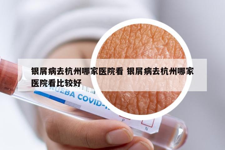 银屑病去杭州哪家医院看 银屑病去杭州哪家医院看比较好