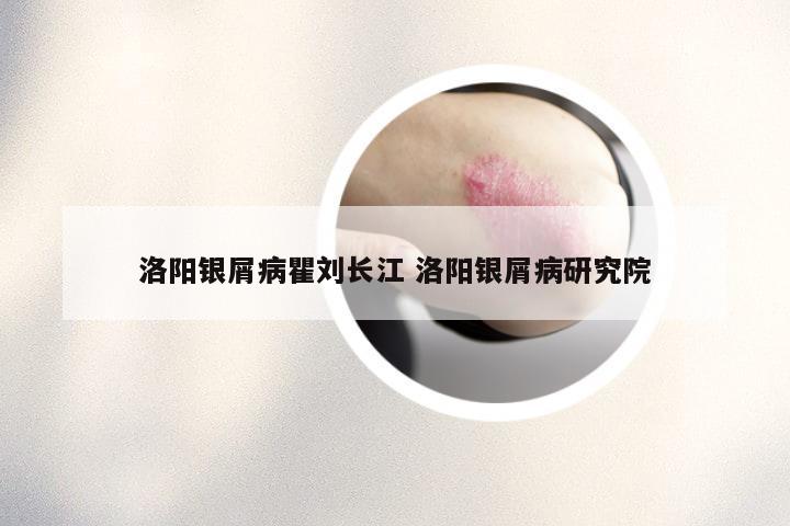 洛阳银屑病瞿刘长江 洛阳银屑病研究院