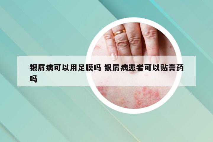 银屑病可以用足膜吗 银屑病患者可以贴膏药吗