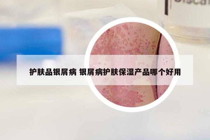 护肤品银屑病 银屑病护肤保湿产品哪个好用
